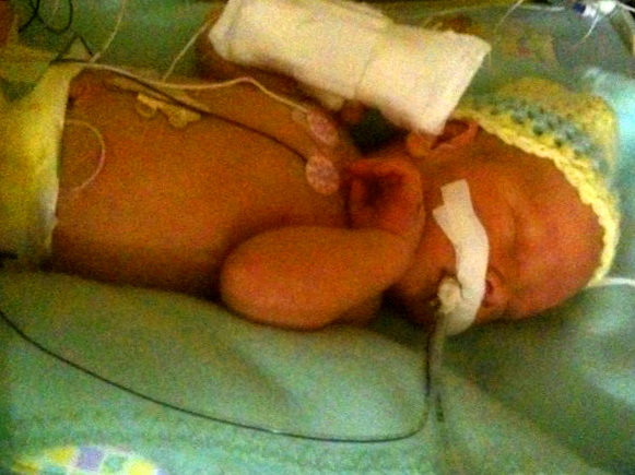A baby named Hunter in the NICU wearing a hat and diaper with tubes and wires attached to him.
